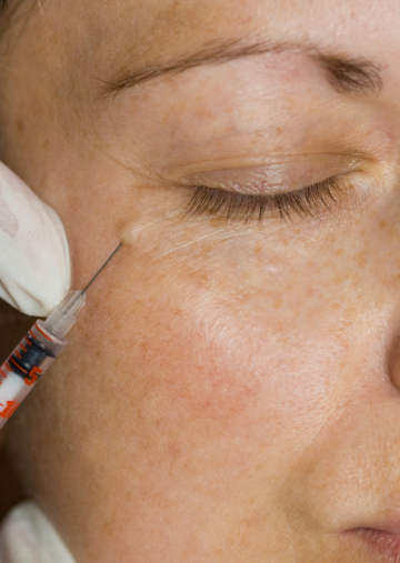 Injectables