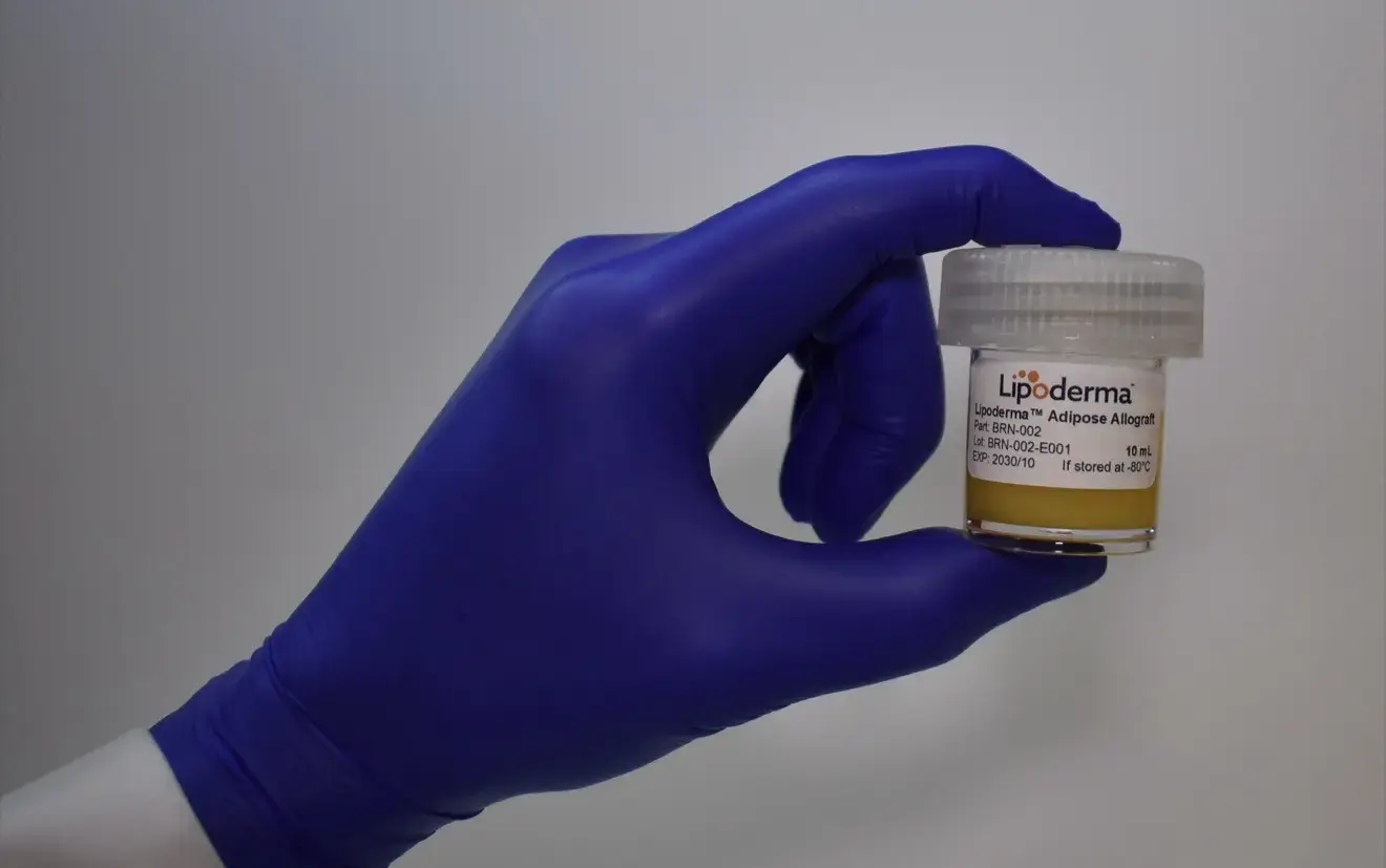 Gloved hand holding a small vial labeled Lipoderm adipose allograft with a white cap, against a neutral background.