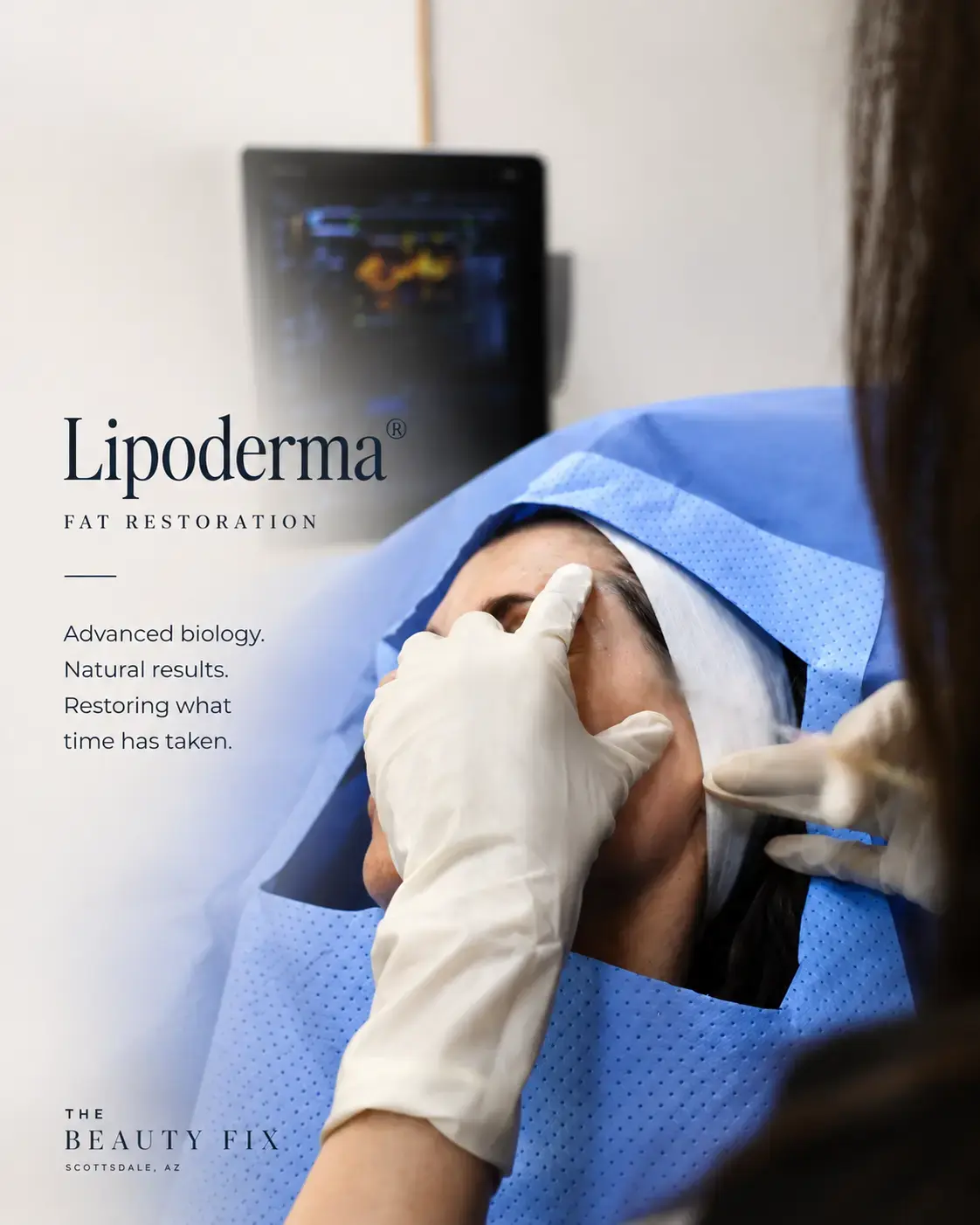Lipoderma fat restoration treatment at The Beauty Fix Medspa in Scottsdale